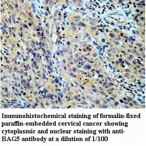 BAG5 Antibody