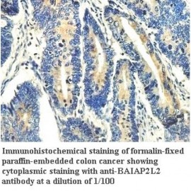 BAIAP2L2 Antibody