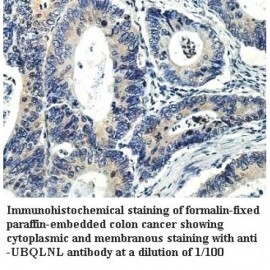 UBQLNL Antibody
