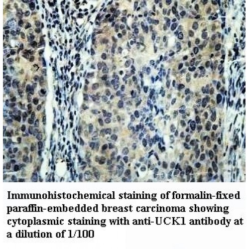 UCK1 Antibody