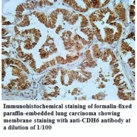 CDH6 Antibody