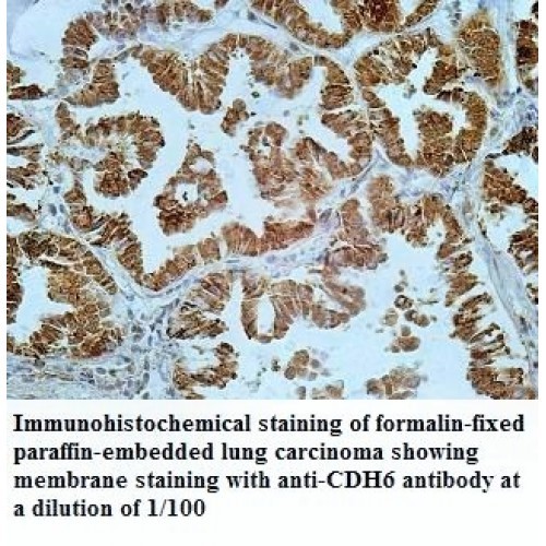 CDH6 Antibody