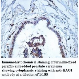 BAG1 Antibody