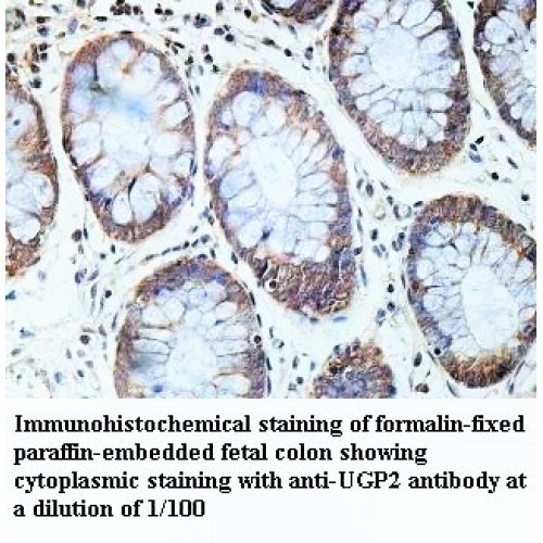 UGP2 Antibody