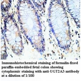 UGT2A3 Antibody