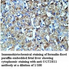 UGT2B11 Antibody