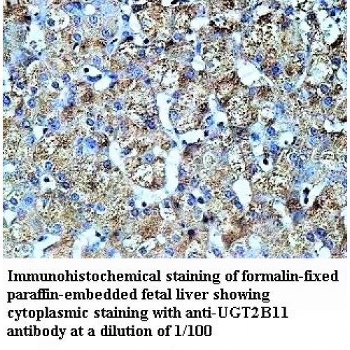 UGT2B11 Antibody