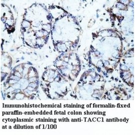 TACC1 Antibody