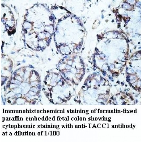 TACC1 Antibody