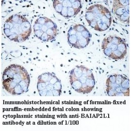 BAIAP2L1 Antibody