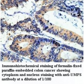 UMPS Antibody
