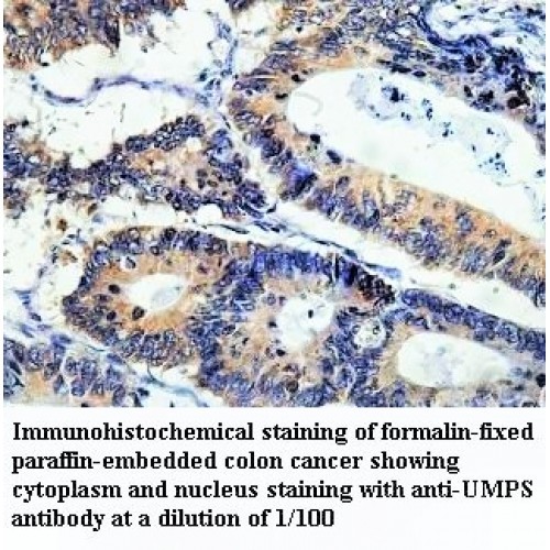 UMPS Antibody