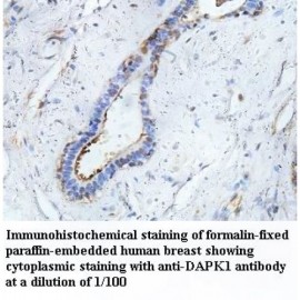DAPK1 Antibody