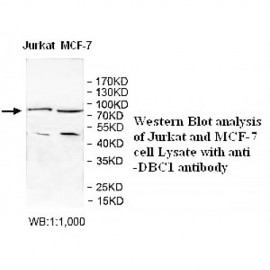 DBC1 Antibody