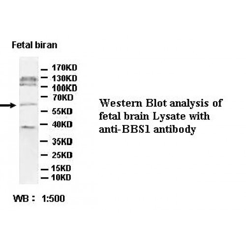 BBS1 Antibody