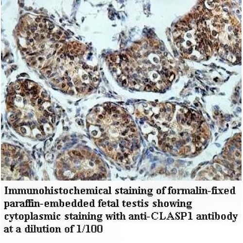 CLASP1 Antibody