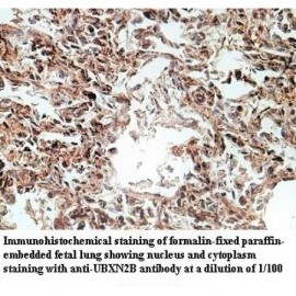 UBXN2B Antibody