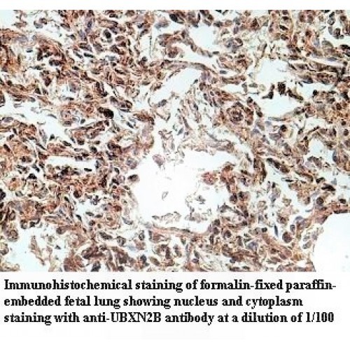 UBXN2B Antibody