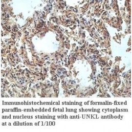 UNKL Antibody