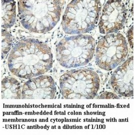 USH1C Antibody