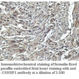 USHBP1 Antibody