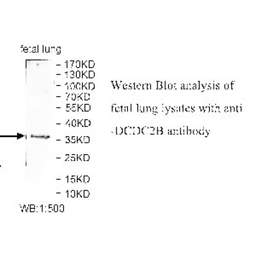 DCDC2B Antibody