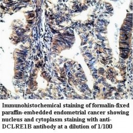 DCLRE1B Antibody