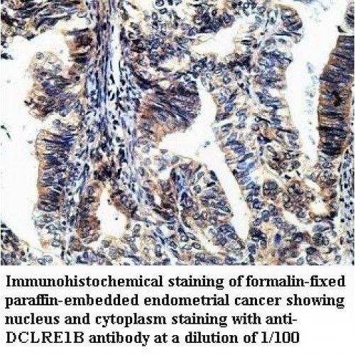 DCLRE1B Antibody