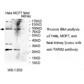 TARS2 Antibody