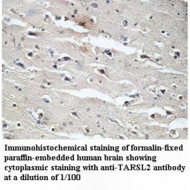 TARSL2 Antibody