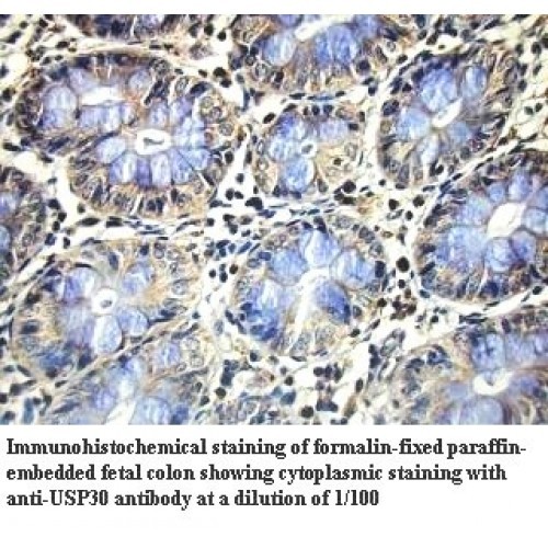 USP30 Antibody
