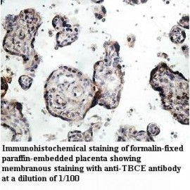TBCE Antibody