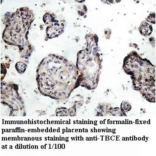 TBCE Antibody