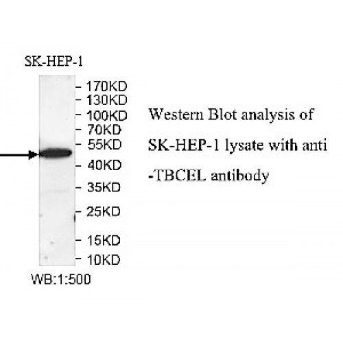 TBCEL Antibody