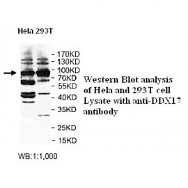 DDX17 Antibody