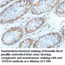DDX24 Antibody
