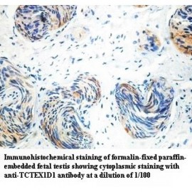 TCTEX1D1 Antibody