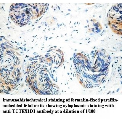 TCTEX1D1 Antibody