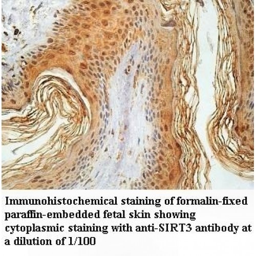 SIRT3 Antibody