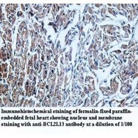 BCL2L13 Antibody
