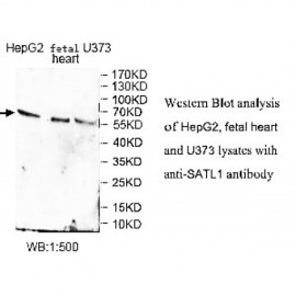 SATL1 Antibody