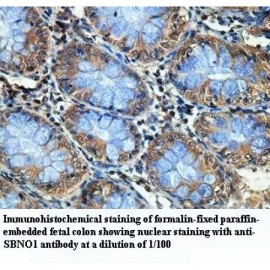 SBNO1 Antibody
