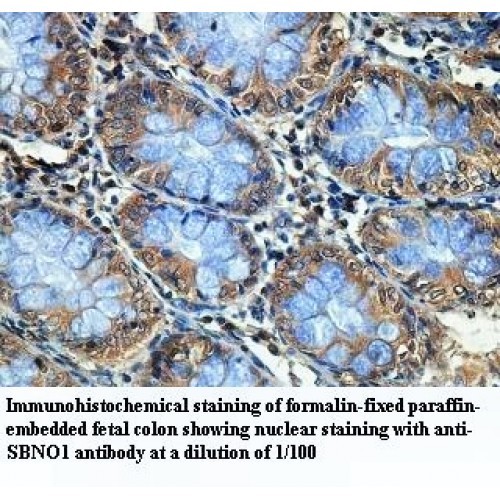SBNO1 Antibody
