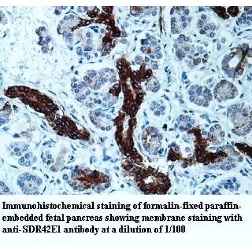 SDR42E1 Antibody