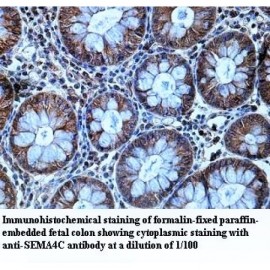 SEMA4C Antibody