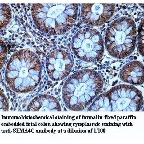 SEMA4C Antibody