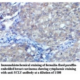 SCLY Antibody