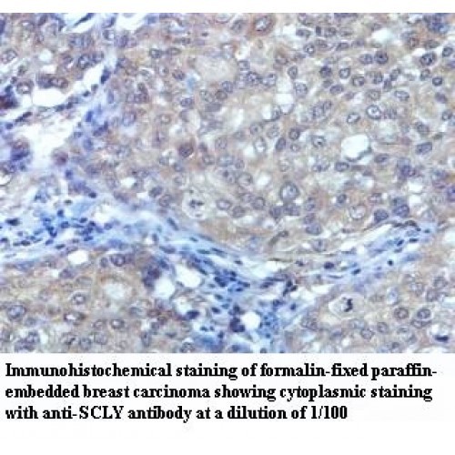 SCLY Antibody