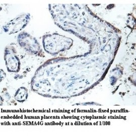 SEMA4G Antibody