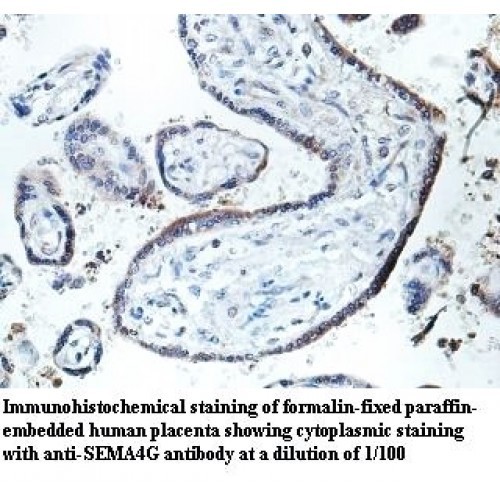 SEMA4G Antibody